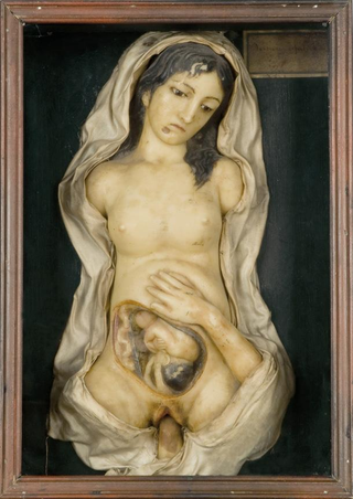 Illustration for article titled Creepy wax anatomy models from the 1700-1800s. Apologies if you planned on sleeping tonight.